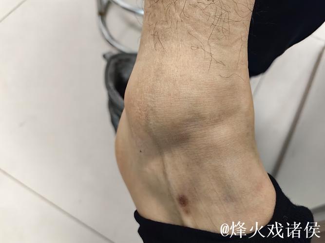 加福德：右脚踝感觉好多了，这是长时间以来感觉最好的一次